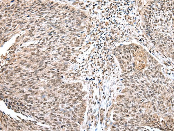 WDR18 Antibody