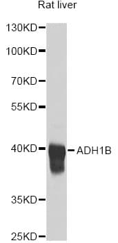 ADH2 / ADH1B Antibody