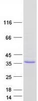 Human OGFOD2 Protein (Recombinant Myc-DDK (Flag))