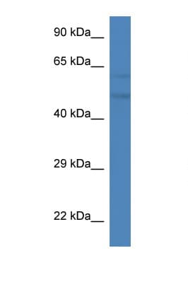 PFKFB2 Antibody (C-Terminus)