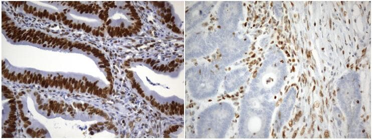 MSH2 Antibody (aa1-304, clone UMAB259)