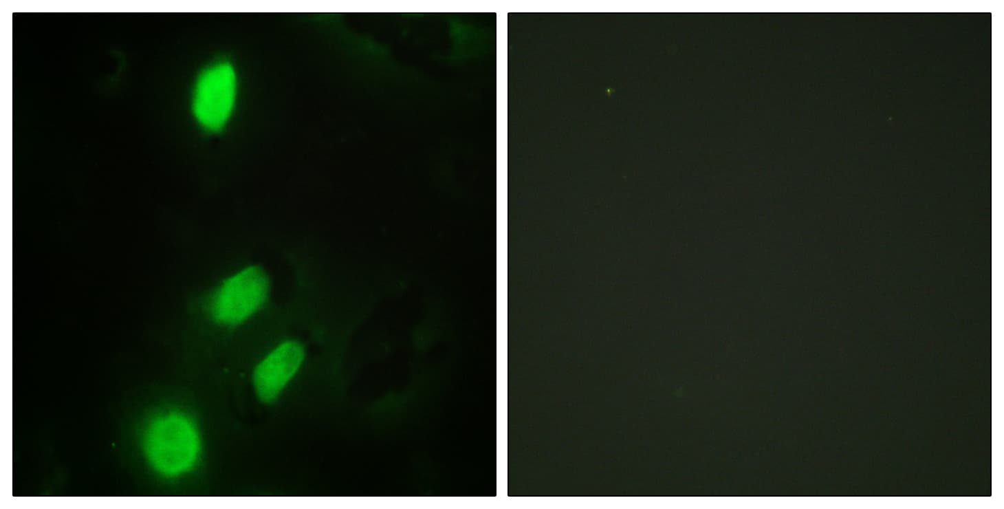 ETV6 / TEL Antibody (aa371-420)