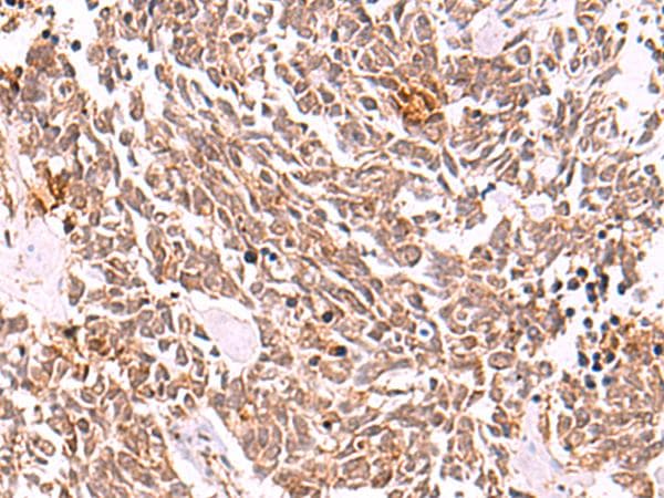 COPS3 / CSN3 Antibody