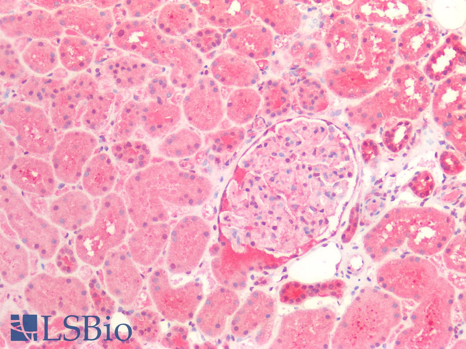 IHC-plus™ Polyclonal Rabbit anti-Human L1CAM Antibody (IHC)