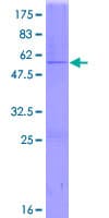 Human GSTA2 Protein (Recombinant GST)