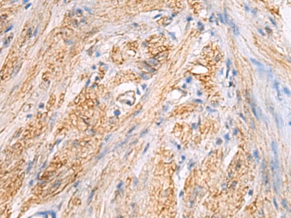 TMOD3 / Tropomodulin 3 Antibody