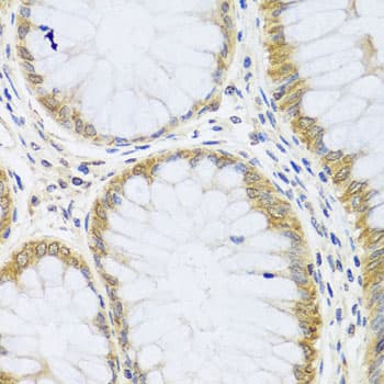 IHC-plus™ ARL6 Antibody