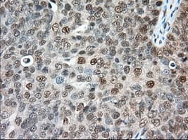 ERCC1 Antibody (clone OTI1C6)