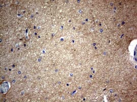 Monoclonal Mouse anti-Human VILIP / VSNL1 Antibody (clone OTI7E11, IHC, WB)