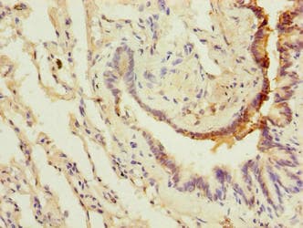 LRRC8E Antibody (aa353-630)
