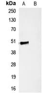 Polyclonal Rabbit Hemagglutinin / HA Tag Antibody (WB)