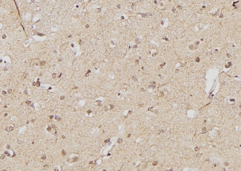 FOXP3 Antibody