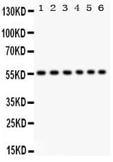 Polyclonal Rabbit anti-Human CD8A / CD8 Alpha Antibody (aa22-187, IHC, WB)