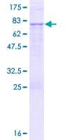 Human YARS2 Protein (Recombinant GST)
