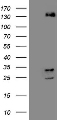 ZNF217 Antibody (aa730-1048, clone OTI1G8)