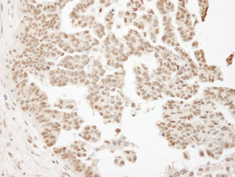 Polyclonal Rabbit anti-Human ARID1B / BAF250B Antibody (aa1850-1900, IHC)
