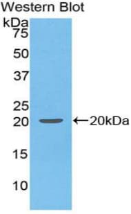 IFNA4 / Interferon Alpha 4 Antibody (aa26-186)