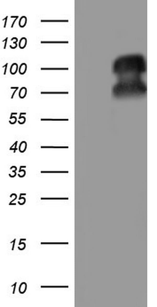 PR / Progesterone Receptor Antibody (aa1-298, clone OTI2C2)