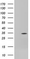Monoclonal Mouse anti-Human SLIM / FHL1 Antibody (clone OTI2E1, IF, WB)