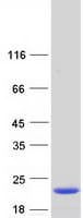 Human IL36RN / IL1F5 Protein (Recombinant Myc-DDK (Flag))