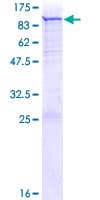 Human PADI3 Protein (Recombinant GST)