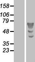 TBL1X / TBL1 Protein (Over-Expression Lysate Myc-DDK (Flag))