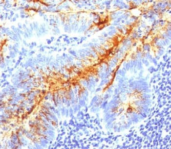 TAG-72 Antibody (clone B72.3 + CA72/733)