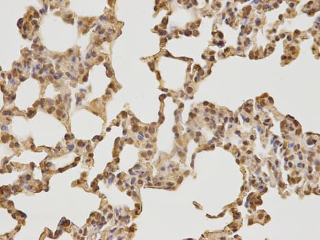 Polyclonal Rabbit anti-Human CDK4 Antibody (IHC, IF, WB)