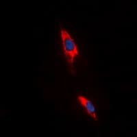 ADORA3 / Adenosine A3 Receptor Antibody (C-Terminus)