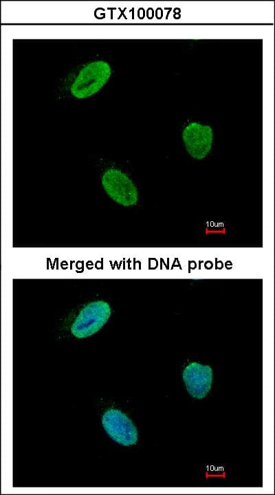 Polyclonal Rabbit anti-Human RAD9A / RAD9 Antibody (aa197-421, IHC, WB)