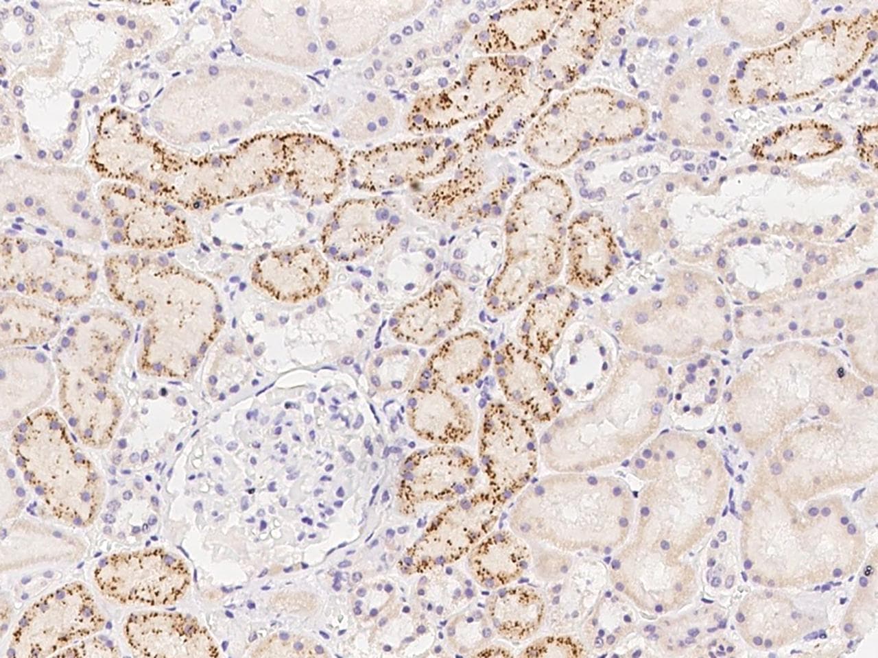 TACR3 / NK3R Antibody