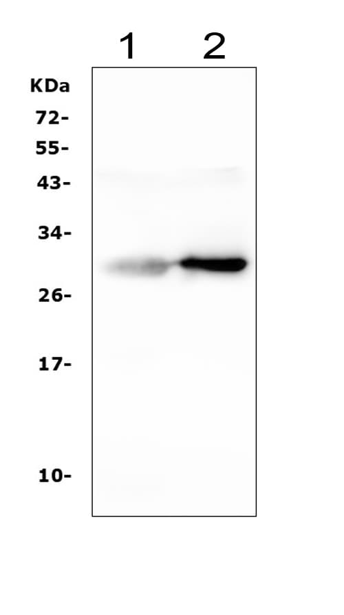 APCS / Serum Amyloid P / SAP Antibody (aa21-228)