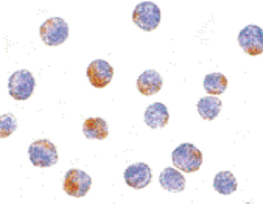 IHC-plus™ Polyclonal Rabbit anti-Human DDX3 / DDX3X Antibody (IHC, WB)