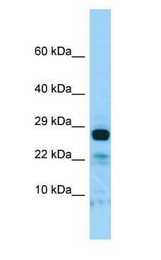 IL-22BP / IL22RA2 Antibody (aa166-215)