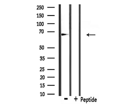 IVL / Involucrin Antibody