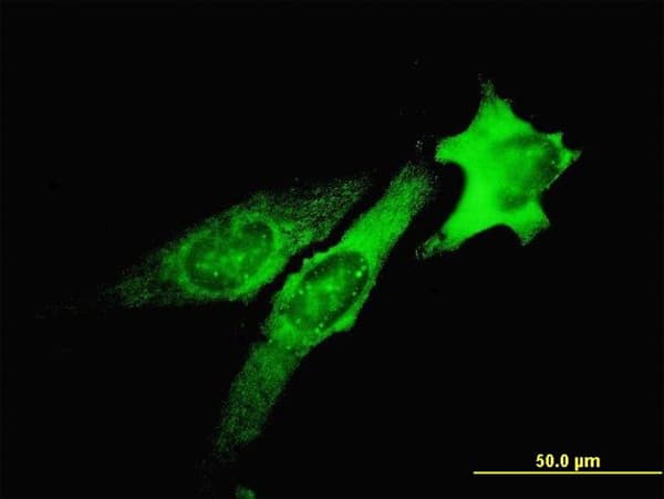 IHC-plus™ TSG101 Antibody (clone 5B7)