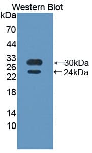 ETK / BMX Antibody (aa287-523)