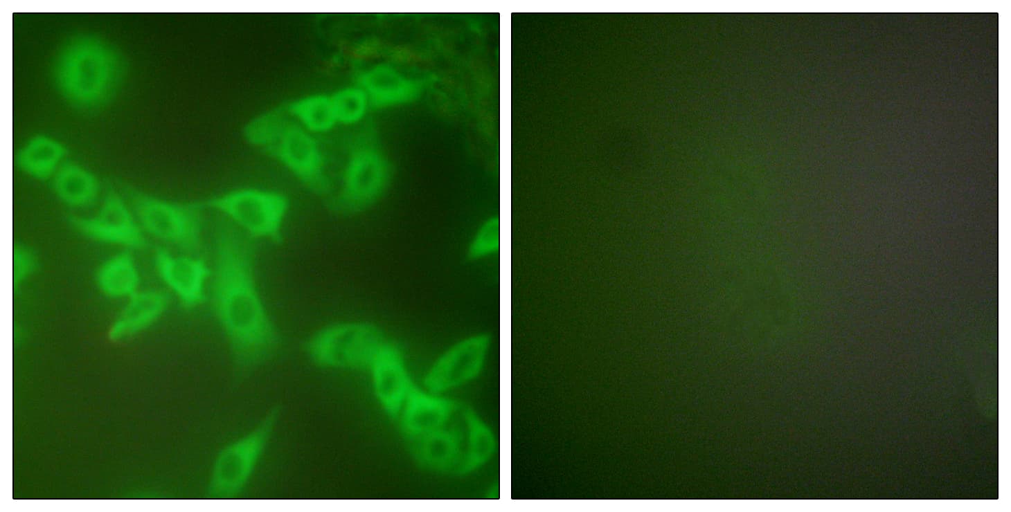 CSTB / Cystatin B / Stefin B Antibody (aa49-98)
