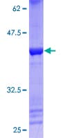 Human LMX1A Protein (Recombinant GST)