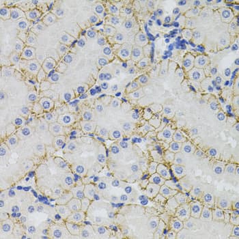 IHC-plus™ SLC1A4 / ASCT1 Antibody