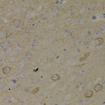 ADCYAP1R1 / PAC1 Receptor Antibody