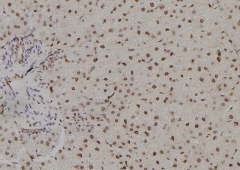 Polyclonal Rabbit anti-Human TSHZ1 Antibody (IHC, WB)