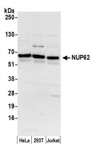 NUP62 Antibody (aa75-125)