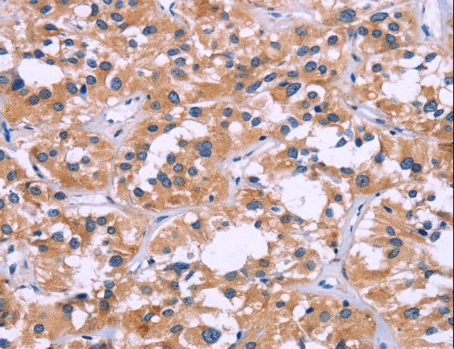 ZEB2 / SIP-1 Antibody