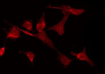 GABRD Antibody