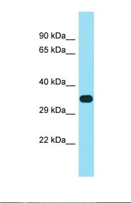 Polyclonal Rabbit anti-Human FAM102B Antibody (aa211-260, WB)