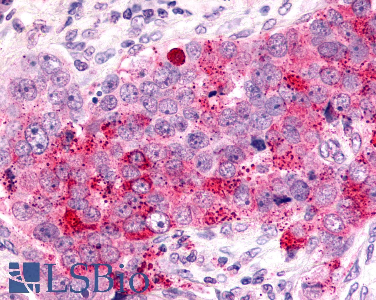 IHC-plus™ CXCR6 Antibody (C-Terminus)