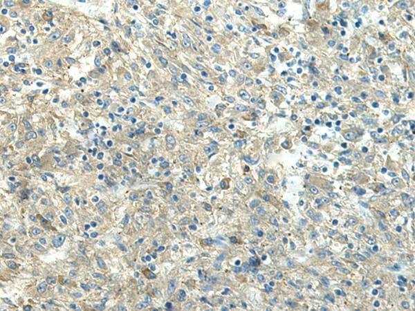 Polyclonal Rabbit anti-Human FCGRT / FCRN Antibody (IHC, WB)