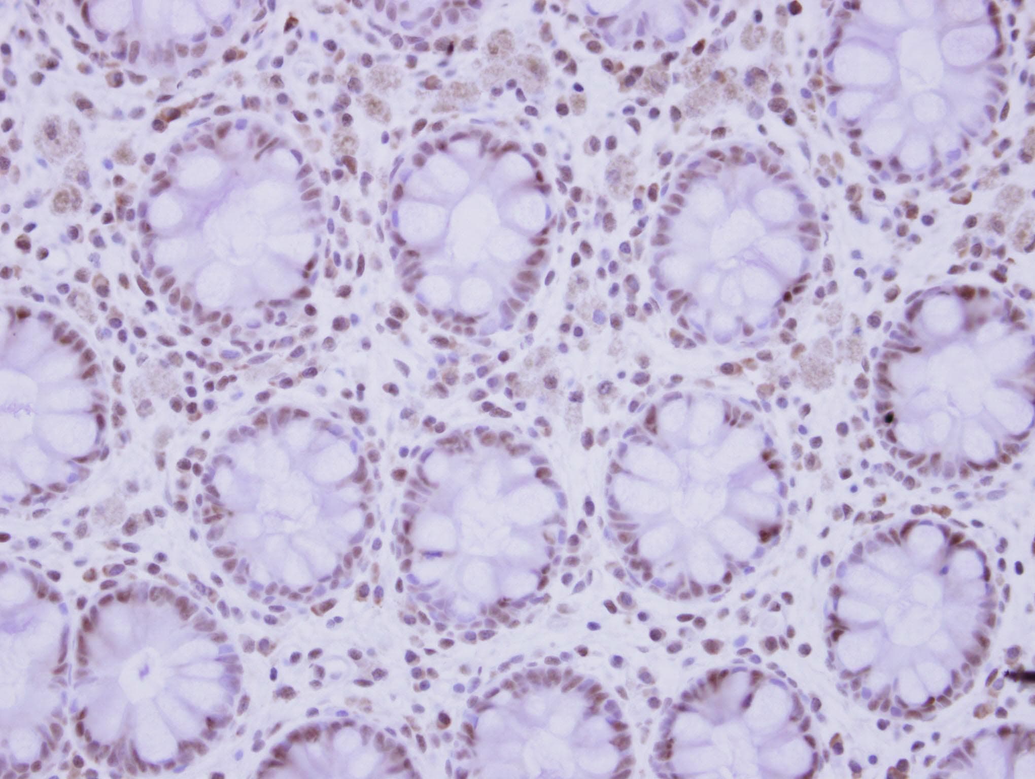 ZNF418 Antibody (Internal)