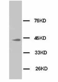 ERK1 + ERK2 Antibody (N-Terminus)